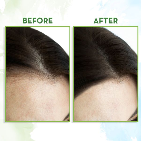 rosemary essential oil for hair growth